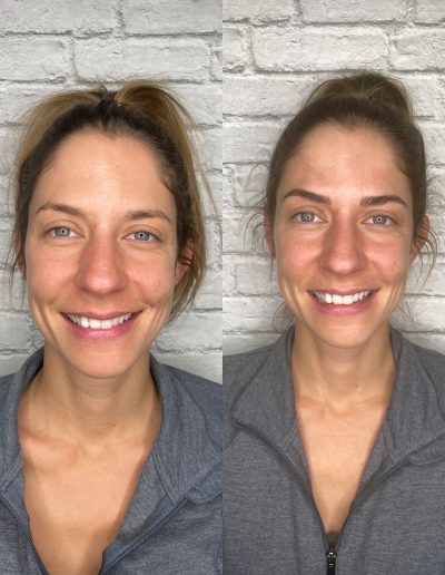 Before and after photo of microblading done on a client example 24 from Aesthetically Speaking in Reno, Nevada.